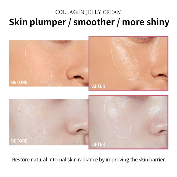100ml-Collagen-Jelly-Cream-Niacinamide-Tightening-Soothing-Moisturizing-Anti-Aging-Firmness-Hydration-Skincare-100ml-Face-Gel.png